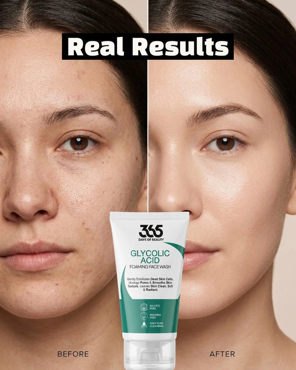 Glycolic Acid Foaming Face Wash – Exfoliating & Pore Cleansing