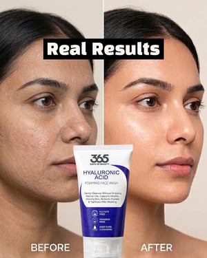 Hyaluronic Acid Face Wash – Hydrating